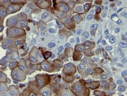 NGFR/TNFRSF16/p75NTR Antibody (NGFR5), Novus Biologicals 0.2mg; Unlabeled:Antibodies,